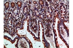 Immunohistochemical analysis of paraffin-embedded human-small-intestine, antibody was diluted at 1:200 (BTLA antibody  (AA 101-150))