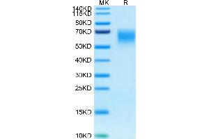 Human CD200 R1 on Tris-Bis PAGE under reduced condition. (CD200R1 Protein (His-Avi Tag))