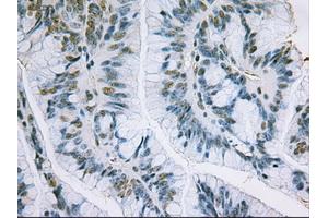 Immunohistochemical staining of paraffin-embedded liver using anti-EpCAM (ABIN2452541) mouse monoclonal antibody. (EpCAM antibody  (AA 24-265))