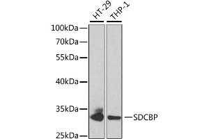 Western blot analysis of extracts of various cell lines, using SDCBP antibody. (SDCBP antibody)