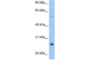 METTL7B antibody used at 1 ug/ml to detect target protein. (METTL7B antibody  (Middle Region))
