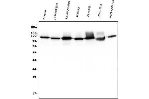 Western blot analysis of Hexokinase 1/HK1 using anti-Hexokinase 1/HK1 antibody (ABIN7600258).