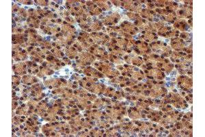 Image no. 3 for anti-Mannose Phosphate Isomerase (MPI) antibody (ABIN1499545) (MPI antibody)