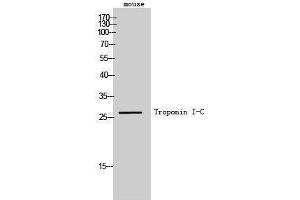 Western Blotting (WB) image for anti-Cardiac Troponin C (TNNC1) antibody (ABIN3180933) (TNNC1 antibody)
