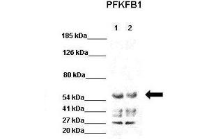 WB Suggested Anti-PFKFB1 Antibody  Positive Control: Lane 1: 40ug HEK293 lysate Lane 2: 40ug H1299 lysate  Primary Antibody Dilution :  1:1000 Secondary Antibody : Goat anti-rabbit-HRP  Secondry Antibody Dilution :  1:5000 Submitted by: Jose Luis Rosa, Universitat de Barcelona (PFKFB1 antibody  (C-Term))