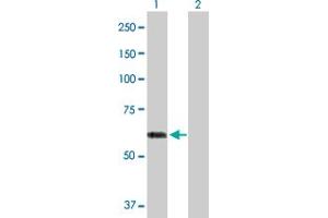 Western Blot analysis of ACCS expression in transfected 293T cell line by ACCS MaxPab polyclonal antibody. (PHACS antibody  (AA 1-501))
