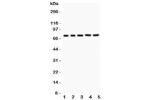Western blot testing of RIP1 antibody and Lane 1:  Jurkat (RIPK1 antibody  (AA 316-671))