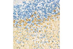 Immunohistochemistry analysis of paraffin embedded mouse cerebellum using HOMER3 (ABIN7074257) at dilution of 1: 2100