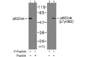 Image no. 2 for anti-Docking Protein 1, 62kDa (Downstream of tyrosine Kinase 1) (DOK1) (AA 360-364) antibody (ABIN197537) (DOK1 antibody  (AA 360-364))