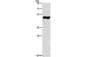 Western blot analysis of Mouse pancreas tissue, using ILK Polyclonal Antibody at dilution of 1:550 (ILK antibody)