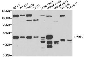 Western blot analysis of extracts of various cell lines, using P2RX2 antibody. (P2RX2 antibody)