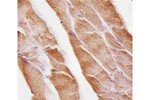 Immunohistochemical analysis of paraffin-embedded mouse skeletal muscle using Musk antibody at 1:25 dilution. (MUSK antibody)