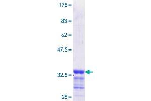 EGR2 Protein (AA 217-293) (GST tag)