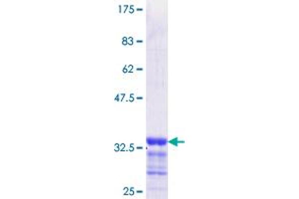 EGR2 Protein (AA 217-293) (GST tag)