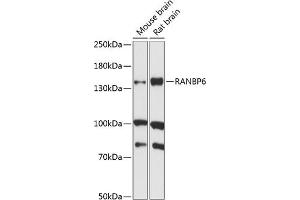 Western blot analysis of extracts of various cell lines, using R antibody (ABIN7269845) at 1:1000 dilution. (RANBP6 antibody  (AA 1-70))