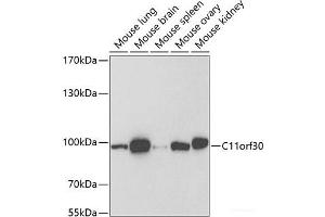 Western blot analysis of extracts of various cell lines using C11orf30 Polyclonal Antibody at dilution of 1:1000. (EMSY antibody)