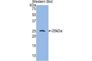 Western blot analysis of the recombinant protein. (HSP27 antibody  (AA 1-209))