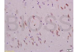 Formalin-fixed and paraffin embedded rat brain labeled with Anti-Sema4C/SEMA5A Polyclonal Antibody, Unconjugated (ABIN737991) at 1:200 followed by conjugation to the secondary antibody and DAB staining. (SEMA4C antibody  (AA 751-833))