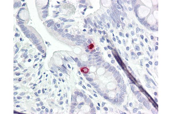 Neurotrimin antibody  (AA 91-140)