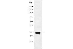 Western blot analysis of RAB8A using COS7 whole cell lysates (RAB8A antibody)