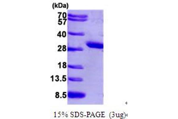 ICMT Protein (AA 1-227) (His tag)