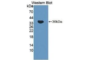 Detection of Recombinant VASN, Mouse using Polyclonal Antibody to Vasorin (VASN) (Vasn antibody  (AA 299-559))
