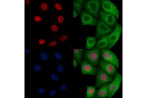 ABIN6256450 and ABIN6267096 staining Heat-shock treated Hela cells by IF/ICC.