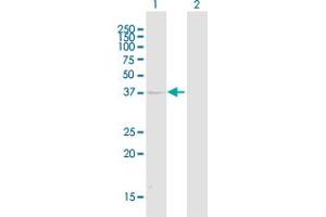 Western Blot analysis of KIR2DL1 expression in transfected 293T cell line ( H00003802-T01 ) by KIR2DL1 MaxPab polyclonal antibody. (KIR2DL1 antibody  (AA 1-374))