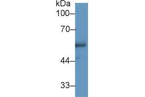 Western Blot; Sample: Human Urine; Primary Ab: 1µg/ml Rabbit Anti-Human CETP Antibody Second Ab: 0. (CETP antibody  (AA 353-443))