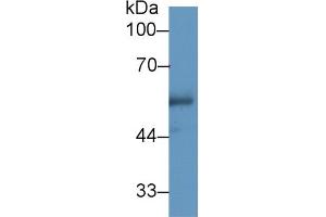 Western Blot; Sample: Human Urine; Primary Ab: 1µg/ml Rabbit Anti-Human CETP Antibody Second Ab: 0.