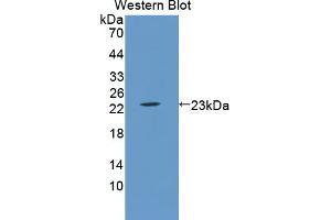 Western blot analysis of the recombinant protein. (LCN5 antibody  (AA 28-187))
