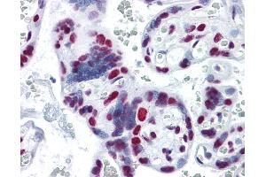 Anti-HNRNPM / HNRPM antibody IHC of human placenta. (HNRNPM antibody  (AA 17-113))