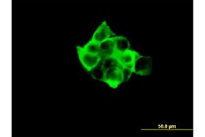 Immunofluorescence (IF) image for anti-Ribosomal Protein S6 Kinase, 70kDa, Polypeptide 1 (RPS6KB1) (AA 416-525) antibody (ABIN519894)