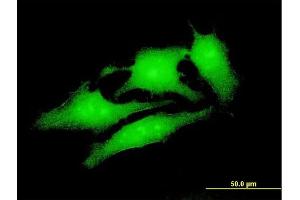 Immunofluorescence of monoclonal antibody to UBE4A on HeLa cell. (UBE4A antibody  (AA 974-1073))