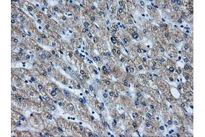 Immunohistochemical staining of paraffin-embedded liver tissue using anti-AKR1A1mouse monoclonal antibody. (AKR1A1 antibody)