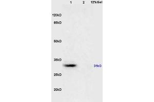 L1 mouse brain lysates L2 mouse kidney lysates probed with Anti 14-3-3(Alpha/Beta/Gamma/Delta/Epsilon) Polyclonal Antibody, Unconjugated (ABIN726710) at 1:200 overnight at 4 °C. (14-3-3 Pan (AA 174-245) antibody)