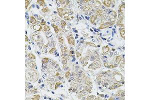 Immunohistochemistry of paraffin-embedded human stomach using CASP12 antibody. (Caspase 12 antibody)