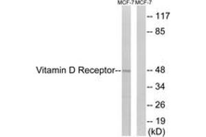 Western blot analysis of extracts from MCF-7 cells, using Vitamin D Receptor (Ab-208) Antibody. (Vitamin D Receptor antibody  (AA 181-230))