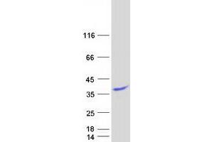 Validation with Western Blot (BLOC1S3 Protein (Myc-DYKDDDDK Tag))