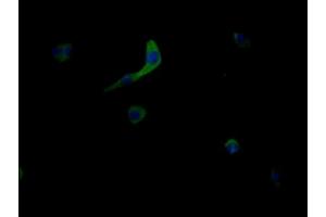 Immunofluorescent analysis of MCF-7 cells using ABIN7159013 at dilution of 1:100 and Alexa Fluor 488-congugated AffiniPure Goat Anti-Rabbit IgG(H+L) (MRGPRX2 antibody  (AA 286-330))