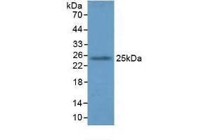 Detection of GSTA4 in Mouse Lung Tissue using Polyclonal Antibody to Glutathione S Transferase A4 (GSTA4) (GSTA4 antibody  (AA 1-222))