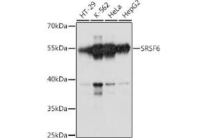Western blot analysis of extracts of various cell lines, using SRSF6 antibody (ABIN7270217) at 1:1000 dilution. (SFRS6 antibody  (AA 1-100))