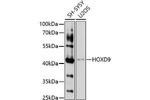 Western blot analysis of extracts of various cell lines, using HOXD9 antibody (ABIN7267776) at 1:1000 dilution. (HOXD9 antibody  (AA 100-200))