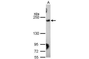 WB Image Sample (30 ug of whole cell lysate) A: Hela 5% SDS PAGE antibody diluted at 1:1000 (COL3A1 antibody  (C-Term))