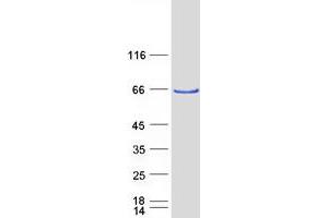 ATE1 Protein (Transcript Variant 2) (Myc-DYKDDDDK Tag)