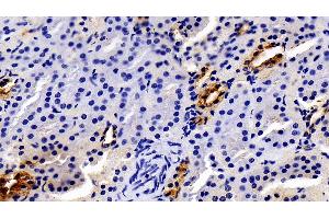 Immunohistochemistry (IHC) image for anti-Janus Kinase 2 (JAK2) (AA 508-800) antibody (ABIN7436057)