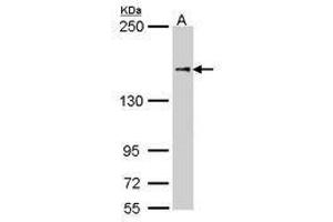 Image no. 2 for anti-Nuclear Factor of Activated T-Cells 5, Tonicity-Responsive (NFAT5) (AA 41-298) antibody (ABIN467533) (NFAT5 antibody  (AA 41-298))