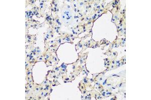 Immunohistochemistry of paraffin-embedded rat lung using ALOX15 antibody at dilution of 1:200 (40x lens).