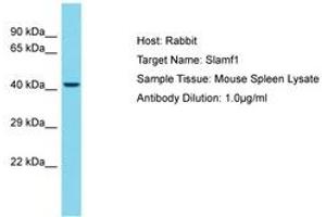 Image no. 1 for anti-Signaling Lymphocytic Activation Molecule Family Member 1 (SLAMF1) (AA 141-190) antibody (ABIN6750480) (SLAMF1 antibody  (AA 141-190))