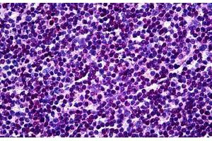 Human Tonsil: Formalin-Fixed, Paraffin-Embedded (FFPE) (MKNK1 antibody  (AA 1-466))